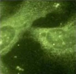 Anti-Presenilin 1 antibody [APS 11] used in Immunocytochemistry/ Immunofluorescence (ICC/IF). GTX15456