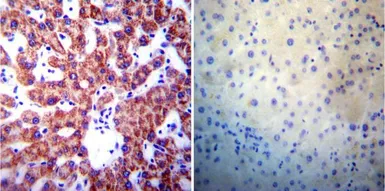 Anti-Presenilin 1 antibody [APS 18] used in IHC (Paraffin sections) (IHC-P). GTX15458