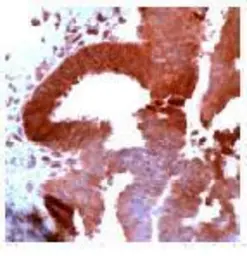 Anti-PDGF Receptor alpha antibody (Ready-to-use) used in IHC (Paraffin sections) (IHC-P). GTX15501