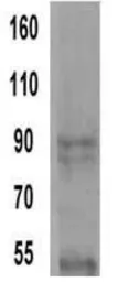 Anti-alpha Actinin 4 antibody [7H6] used in Western Blot (WB). GTX15648