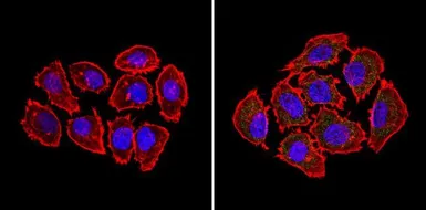 Anti-Bid antibody [23F7] used in Immunocytochemistry/ Immunofluorescence (ICC/IF). GTX15667