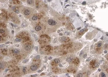 Anti-CLPP antibody, C-term used in IHC (Paraffin sections) (IHC-P). GTX15708