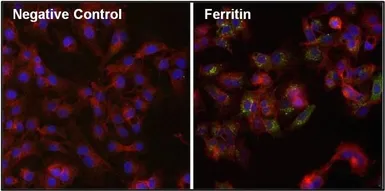 Anti-Ferritin antibody [521] used in Immunocytochemistry/ Immunofluorescence (ICC/IF). GTX15742