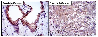 Anti-Glyoxalase I antibody [Glo1a] used in IHC (Paraffin sections) (IHC-P). GTX15747
