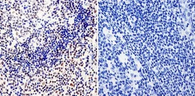 Anti-RPA32 antibody [MA34] used in IHC (Paraffin sections) (IHC-P). GTX15783