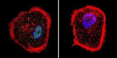 Anti-RPA32 antibody [MA34] used in Immunocytochemistry/ Immunofluorescence (ICC/IF). GTX15783