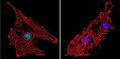 Anti-RPA32 antibody [MA34] used in Immunocytochemistry/ Immunofluorescence (ICC/IF). GTX15783