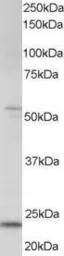 Anti-MAD4 antibody, C-term used in Western Blot (WB). GTX15841
