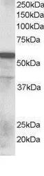 Anti-RNF8 antibody, N-term used in Western Blot (WB). GTX15850