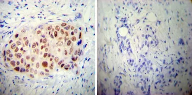 Anti-AP2 alpha antibody [3B5] used in IHC (Paraffin sections) (IHC-P). GTX15878