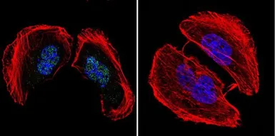 Anti-AP2 alpha antibody [3B5] used in Immunocytochemistry/ Immunofluorescence (ICC/IF). GTX15878