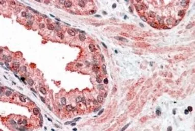 Anti-CCNDBP1 antibody, C-term used in IHC (Paraffin sections) (IHC-P). GTX15960