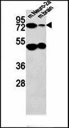 Anti-AVL9 antibody used in Western Blot (WB). GTX16209
