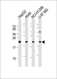 Anti-Epiregulin antibody used in Western Blot (WB). GTX16256