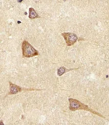 Anti-Epiregulin antibody used in IHC (Paraffin sections) (IHC-P). GTX16256