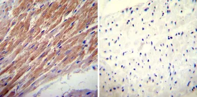 Anti-Glucocorticoid Receptor alpha antibody used in IHC (Paraffin sections) (IHC-P). GTX16318
