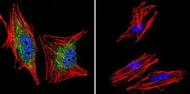 Anti-Glucocorticoid Receptor alpha antibody used in Immunocytochemistry/ Immunofluorescence (ICC/IF). GTX16318