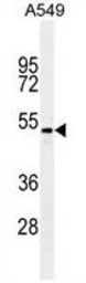 Anti-TGF beta 2 antibody [220ct16.4.3.1] used in Western Blot (WB). GTX16335
