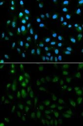 Anti-TFPI antibody used in Immunocytochemistry/ Immunofluorescence (ICC/IF). GTX16395