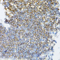 Anti-UBE2D1 antibody used in IHC (Paraffin sections) (IHC-P). GTX16400