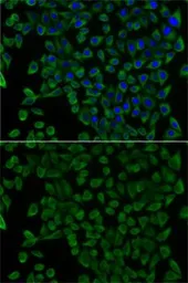 Anti-Transcobalamin 2 antibody used in Immunocytochemistry/ Immunofluorescence (ICC/IF). GTX16437