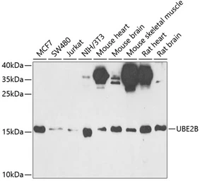Anti-UBE2B antibody used in Western Blot (WB). GTX16443
