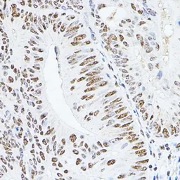 Anti-GAS41 antibody used in IHC (Paraffin sections) (IHC-P). GTX16452