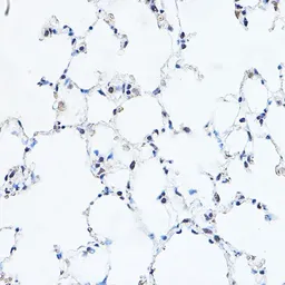 Anti-GAS41 antibody used in IHC (Paraffin sections) (IHC-P). GTX16452