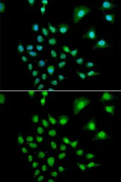 Anti-UBE3C antibody used in Immunocytochemistry/ Immunofluorescence (ICC/IF). GTX16467