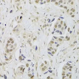 Anti-UBE3C antibody used in IHC (Paraffin sections) (IHC-P). GTX16467
