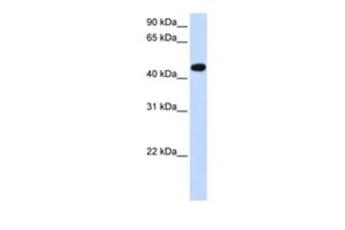 Anti-AADAC antibody, N-term used in Western Blot (WB). GTX16545