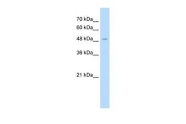Anti-Aminoadipate aminotransferase antibody, N-term used in Western Blot (WB). GTX16585