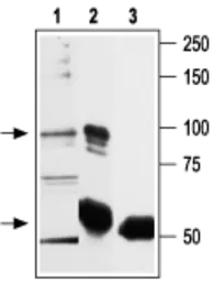 Anti-VRL1 antibody used in Immunoprecipitation (IP). GTX16610