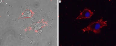Anti-Cav gamma 5 antibody used in Live cell imaging (LCI). GTX16626
