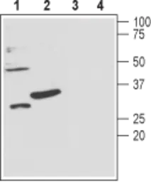 Anti-KCNMB3 antibody used in Western Blot (WB). GTX16677
