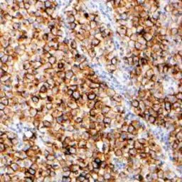 Anti-Placental Alkaline Phosphatase antibody [SP15] used in Immunohistochemistry (IHC). GTX16695