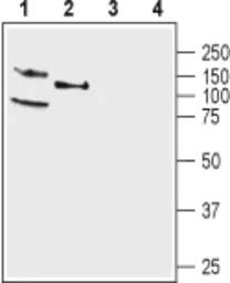 Anti-KCNQ4 antibody used in Western Blot (WB). GTX16778