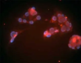 Anti-LDL Receptor antibody [15C8] used in Immunocytochemistry/ Immunofluorescence (ICC/IF). GTX16897