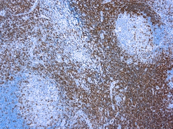 Anti-CD3 antibody (ready-to-use) used in IHC (Paraffin sections) (IHC-P). GTX16930