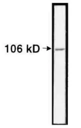 Anti-Nucleolin antibody used in Western Blot (WB). GTX16940