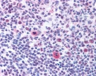 Anti-Nucleolin antibody used in IHC (Paraffin sections) (IHC-P). GTX16940