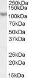 Anti-MAML1 antibody, N-term used in Western Blot (WB). GTX17019