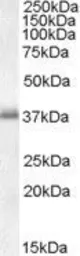 Anti-LAT antibody, C-term used in Western Blot (WB). GTX17032