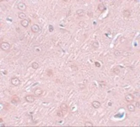 Anti-Synaptogyrin 2 antibody used in IHC (Paraffin sections) (IHC-P). GTX17057