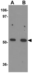 Anti-BANP antibody used in Western Blot (WB). GTX17092