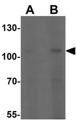 Anti-Klotho antibody used in Western Blot (WB). GTX17093