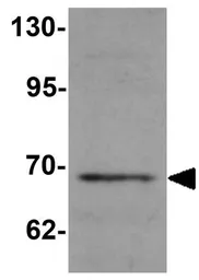 Anti-WIZ antibody used in Western Blot (WB). GTX17094