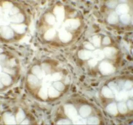 Anti-LRRFIP1 antibody used in IHC (Paraffin sections) (IHC-P). GTX17100