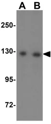 Anti-AP3B2 antibody used in Western Blot (WB). GTX17145