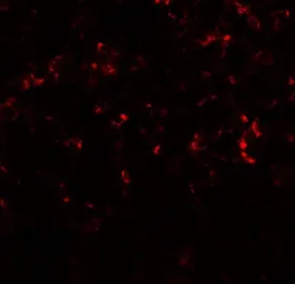 Anti-C/EBP delta antibody used in IHC (Paraffin sections) (IHC-P). GTX17179